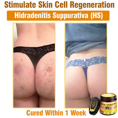 South Moon Bee Venom Pain Relief Cream for Arthritis, Muscle & Joint Discomfort (Original)